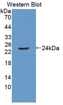 Anoctamin 2 (ANO2) Polyclonal Antibody - image 2