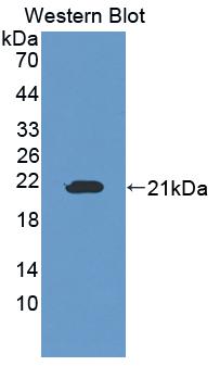 Osteopetrosis Associated Transmembrane Protein 1 (OSTM1) Polyclonal Antibody - image 2