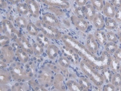 Osteopetrosis Associated Transmembrane Protein 1 (OSTM1) Polyclonal Antibody - image 4