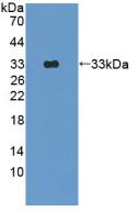 DAB staining on IHC-P; Samples: Rat Lung Tissue; Primary Ab: 10µg/ml Rabbit Anti-Rat OAS1 Antibody Second Ab: 2µg/mL HRP-Linked Caprine Anti-Rabbit IgG Polyclonal Antibody