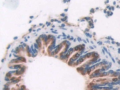 DAB staining on IHC-P; Samples: Rat Large Intestine Tissue.