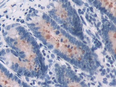 2',5'-Oligoadenylate Synthetase 1 (OAS1) Polyclonal Antibody - image 5