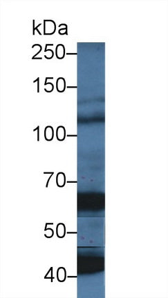 Western Blot; Sample: Porcine Cerebrum lysate; <br/>Primary Ab: 5µg/ml Rabbit Anti-Human OAS1 Antibody<br/>Second Ab: 0.2µg/mL HRP-Linked Caprine Anti-Rabbit IgG Polyclonal Antibody<br/>