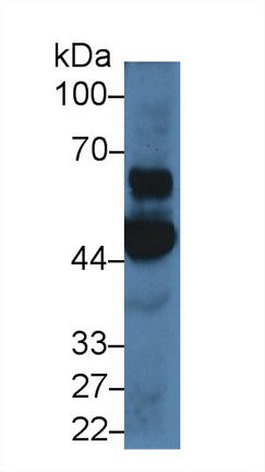 DAB staining on IHC-P; Samples: Human Cerebrum Tissue; Primary Ab: 20µg/ml Rabbit Anti-Human OAS1 Antibody Second Ab: 2µg/mL HRP-Linked Caprine Anti-Rabbit IgG Polyclonal Antibody