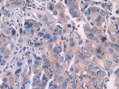 2',5'-Oligoadenylate Synthetase 1 (OAS1) Polyclonal Antibody - image 5