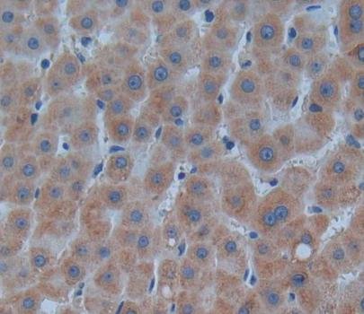 Purine Nucleoside Phosphorylase (PNP) Polyclonal Antibody - image 4