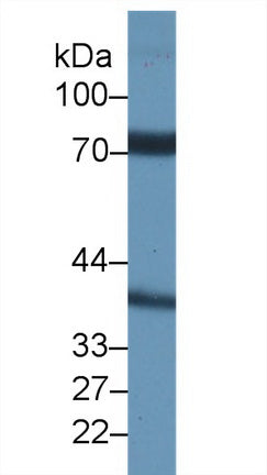 Western Blot; Sample: Recombinant protein.