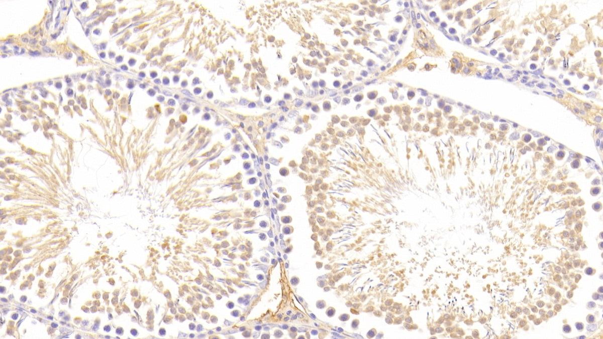 DAB staining on fromalin fixed paraffin- embedded pancreas tissue)