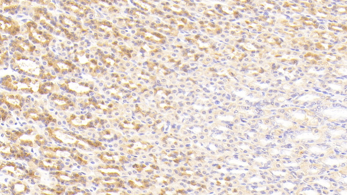 Nicastrin (NCSTN) Polyclonal Antibody - image 5