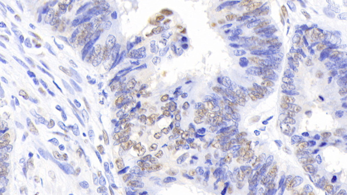 DAB staining on IHC-P. Samples: Human Tissue)