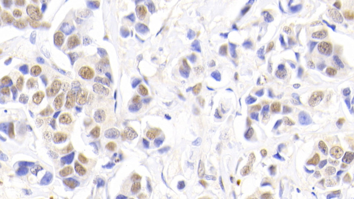 Nucleophosmin 1 (NPM1) Polyclonal Antibody - image 5