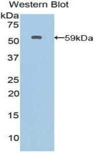 DAB staining on IHC-P; Samples: Human Spleen Tissue;  Primary Ab: 20μg/ml Rabbit Anti-Human MSN Antibody Second Ab: 2µg/mL HRP-Linked Caprine Anti-Rabbit IgG Polyclonal Antibody