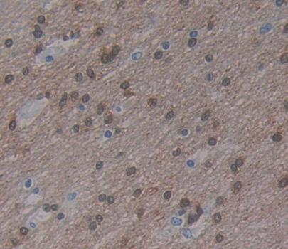 Myelin Transcription Factor 1 (MYT1) Polyclonal Antibody - image 4