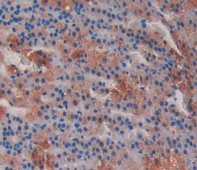 Mitochondrial Tumor Suppressor 1 (MTUS1) Polyclonal Antibody - image 4