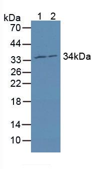 Knockout Varification: ; Lane 1: Wild-type MCF7 cell lysate; ; Lane 2: MRPL1 knockout MCF7 cell lysate; ; Predicted MW: 37kd ; Observed MW: 34kd; Primary Ab: 1µg/ml Rabbit Anti-Human MRPL1 Antibody; Second Ab: 0.2µg/mL HRP-Linked Caprine Anti-Rabbit IgG Polyclonal Antibody;