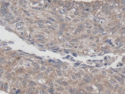 Mitochondrial Ribosomal Protein L1 (MRPL1) Polyclonal Antibody - image 5