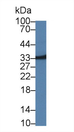 Western Blot; Sample: Recombinant protein.