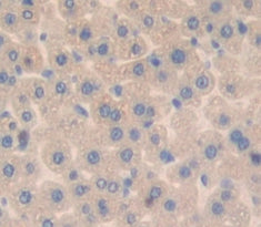 3-Mercaptopyruvate Sulfurtransferase (MST) Polyclonal Antibody - image 4