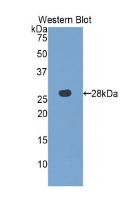 3-Mercaptopyruvate Sulfurtransferase (MST) Polyclonal Antibody - image 2