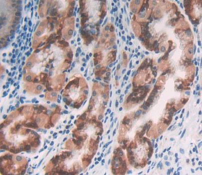 Molybdenum Cofactor Synthesis 1 (MOCS1) Polyclonal Antibody - image 4