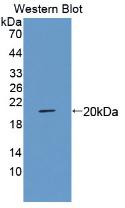Macrophage Receptor With Collagenous Structure (MARCO) Polyclonal Antibody - image 2