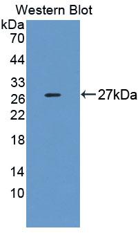 Western Blot; Sample: Lane1: Mouse Testis lysate; Lane2: Human Hela cell lysate; Lane3: Human 293T cell lysate; Lane4: Human Jurkat cell lysate; Primary Ab: 1µg/mL Rabbit Anti-Human ZRF1 Antibody; Second Ab: 0.2µg/mL HRP-Linked Caprine Anti-Rabbit IgG Polyclonal Antibody;