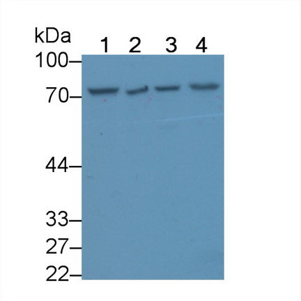 DAB staining on IHC-P; Samples: Human Colon Tissue;  Primary Ab: 20μg/ml Rabbit Anti-Human ZRF1 Antibody Second Ab: 2µg/mL HRP-Linked Caprine Anti-Rabbit IgG Polyclonal Antibody