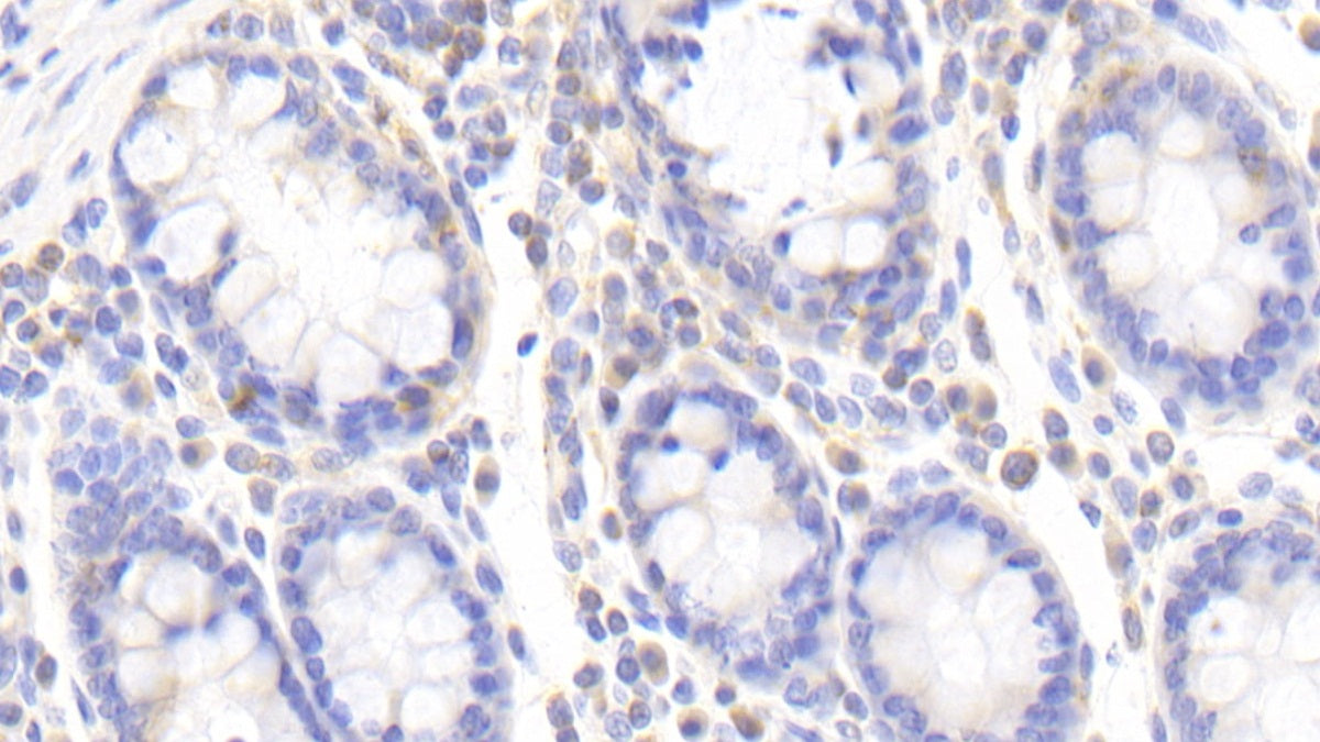 Zuotin Related Factor 1 (ZRF1) Polyclonal Antibody - image 4