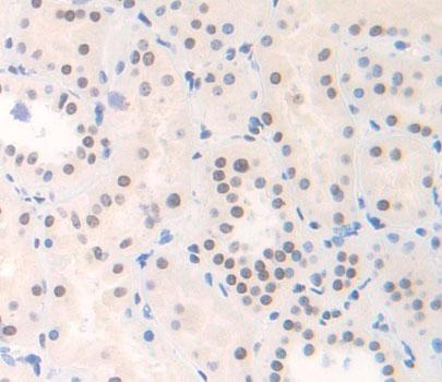 YY1 Associated Factor 2 (YAF2) Polyclonal Antibody - image 3