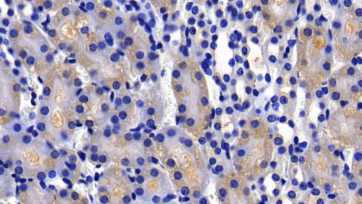 X-linked Inhibitor Of Apoptosis Protein (XIAP) Polyclonal Antibody - image 3