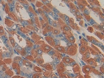 DAB staining on IHC-P; Samples: Mouse Spleen Tissue