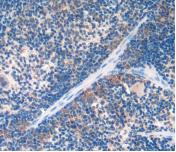 Urocortin 2 (UCN2) Polyclonal Antibody - image 4