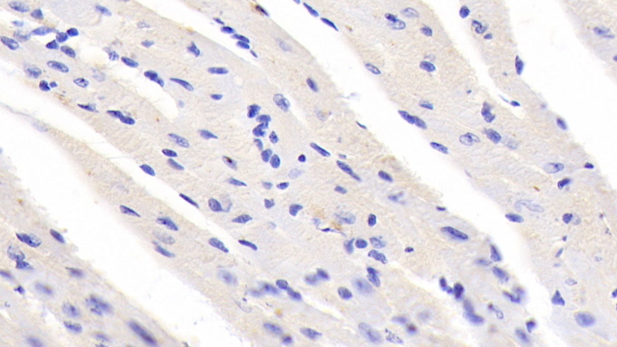 Ubiquitin Associated Protein 1 (UBAP1) Polyclonal Antibody - image 3