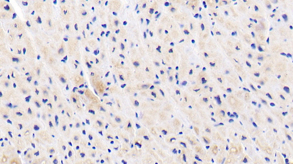 Ubiquitin Associated Protein 1 (UBAP1) Polyclonal Antibody - image 3
