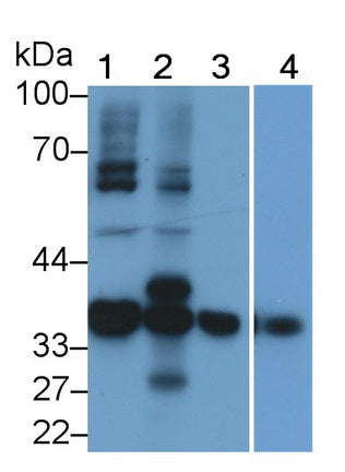 Pim-1 Oncogene (PIM1) Polyclonal Antibody - image 2