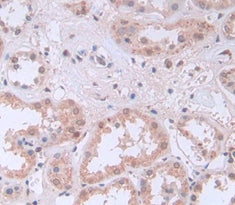 Pim-1 Oncogene (PIM1) Polyclonal Antibody - image 3