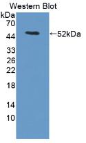 Used in DAB staining on fromalin fixed paraffin-embedded Liver tissue