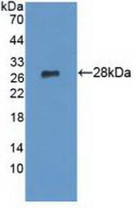 Western Blot; Sample: Lane1: Mouse Liver lysate; Lane2: Rat Liver lysate; Primary Ab: 1µg/mL Rabbit Anti-Human LYPLA1 Ab; Second Ab: 0.2µg/mL HRP-Linked Caprine Anti-Rabbit IgG Polyclonal Antibody;