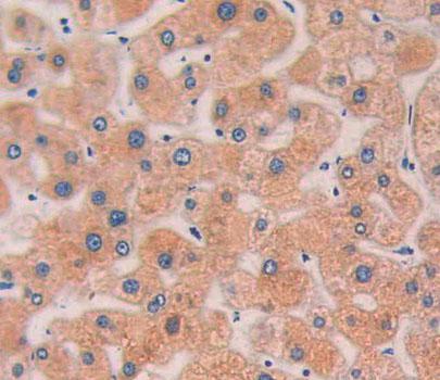 Lysophospholipase I (LYPLA1) Polyclonal Antibody - image 4