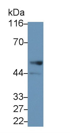 DAB staining on IHC-P; Samples: Rat Small intestine Tissue; Primary Ab: 20µg/ml Rabbit Anti-Rat LSP1 Antibody Second Ab: 2µg/mL HRP-Linked Caprine Anti-Rabbit IgG Polyclonal Antibody