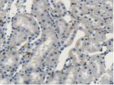 Lymphocyte Specific Protein 1 (LSP1) Polyclonal Antibody - image 5