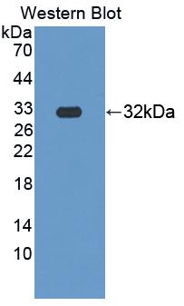 Leucine Rich Repeats And Death Domain Containing Protein (LRDD) Polyclonal Antibody - image 2