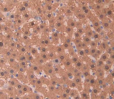 Leucine Rich Repeats And Death Domain Containing Protein (LRDD) Polyclonal Antibody - image 3