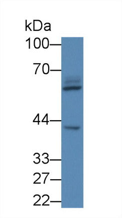 Western Blot; Sample: Recombinant protein.