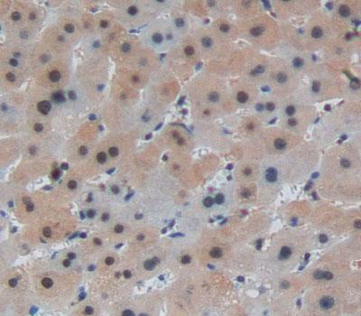 Leucine Rich Repeats And Death Domain Containing Protein (LRDD) Polyclonal Antibody - image 4