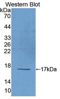 Eukaryotic translation initiation factor 2D (EIF2D) Polyclonal Antibody - image 2