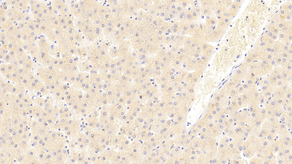 Eukaryotic translation initiation factor 2D (EIF2D) Polyclonal Antibody - image 3