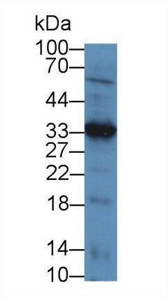 Western Blot; Sample: Recombinant protein.