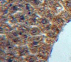 Leukocyte Cell Derived Chemotaxin 1 (LECT1) Polyclonal Antibody - image 4
