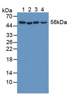 Western Blot; Sample: Recombinant KATNA1, Human.